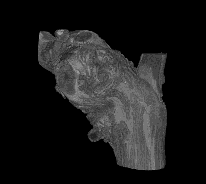 Modelo 3D vid